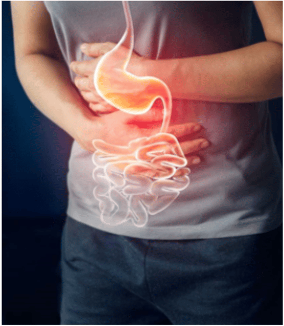 Effect of Unhealthy Gut in the Immune System
