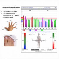 Acugraph Energy Analysis